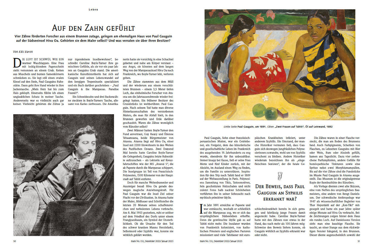 Auf den Zahn gefühlt